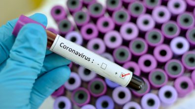 Coronavirus a Reggio Calabria, un nuovo caso positivo al Gom. Il bollettino