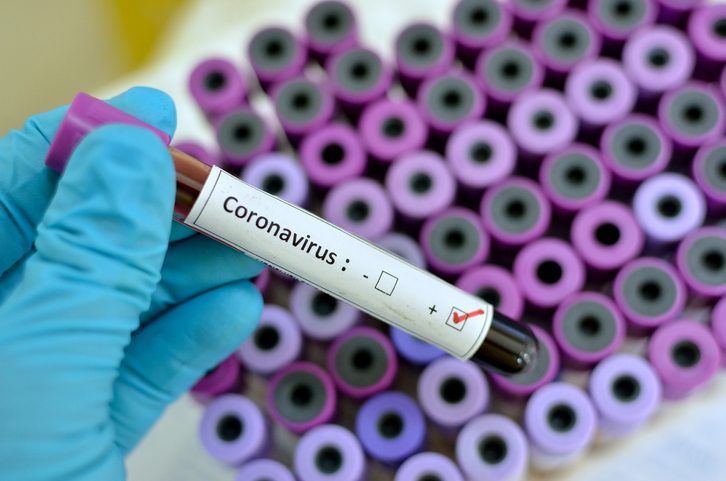 Coronavirus a Reggio Calabria, primo caso positivo a Taurianova