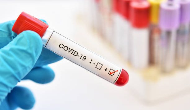 Coronavirus Reggio Calabria, 2 morti e +564 nuovi casi in un giorno