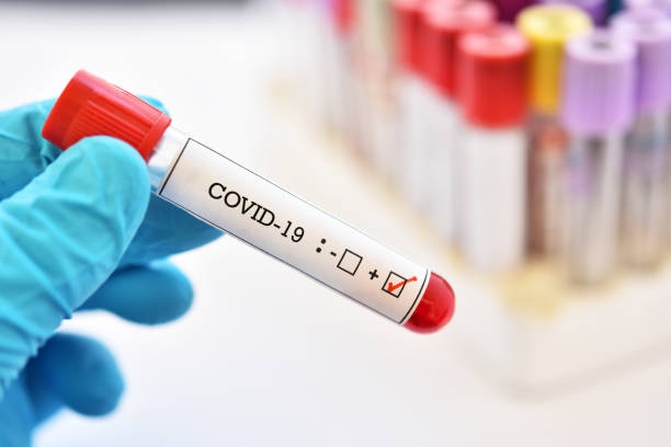 Coronavirus Reggio Calabria, 2 morti e +564 nuovi casi in un giorno