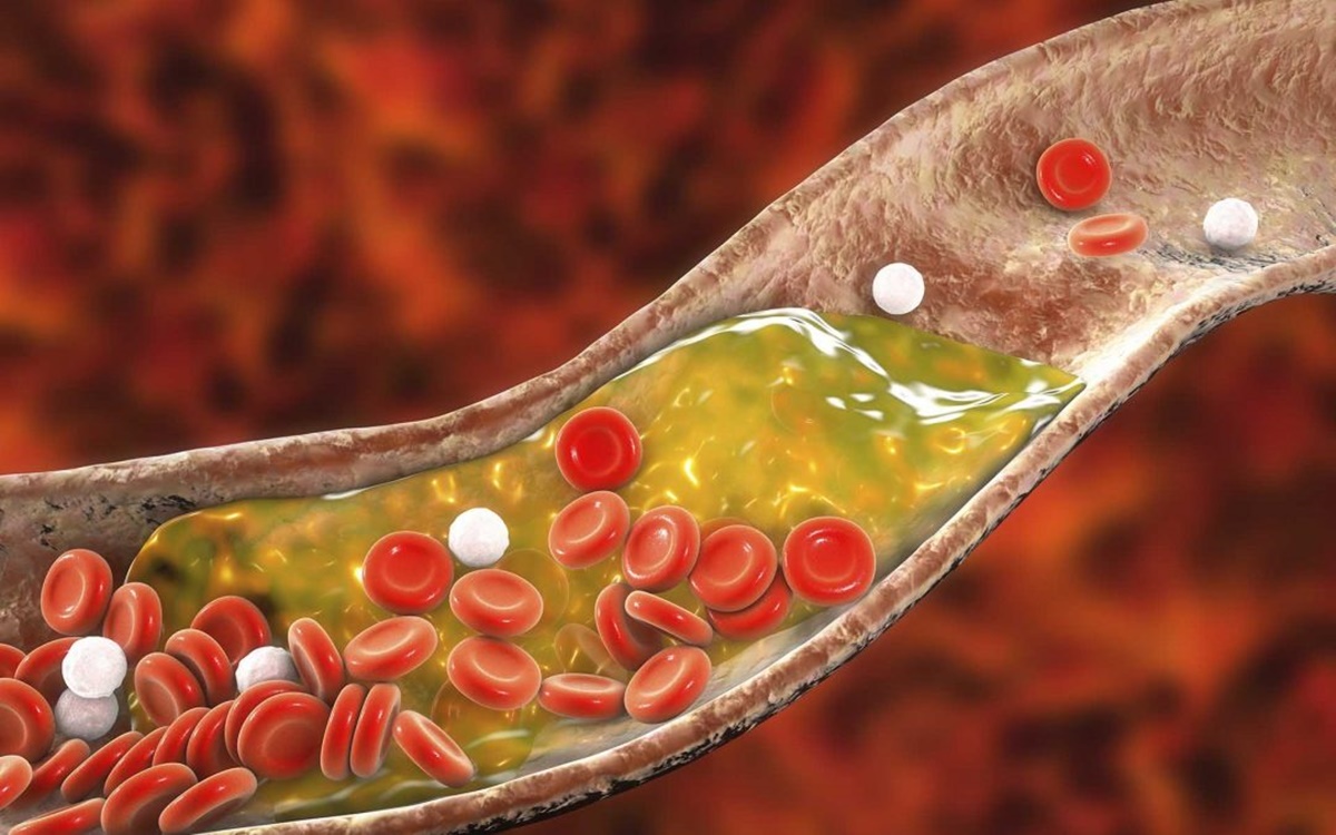 Aifa approva il primo farmaco biologico contro il colesterolo “cattivo”