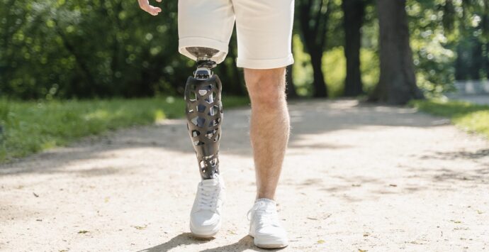 Sanità, l’Onmic denuncia: «Nel Reggino difficoltà a ottenere dispositivi protesici vitali»